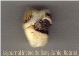 photo scan dent sagesse gatee