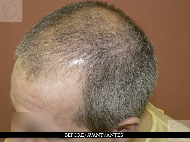 Davines les moyens pour les cheveux