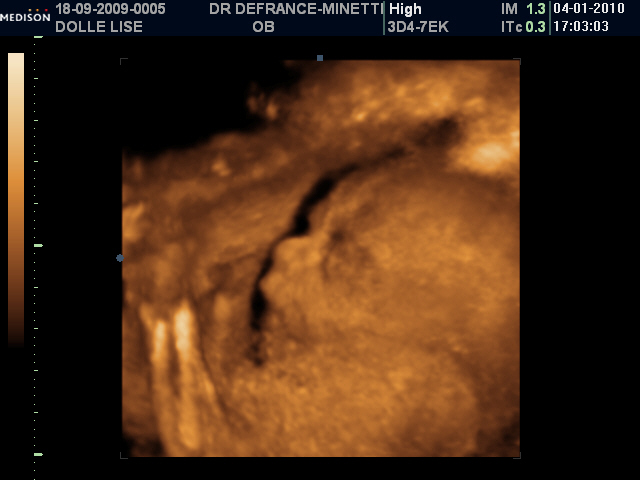 http://nsm02.casimages.com/img/2010/01/25//100125011527965535314408.jpg