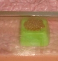 62